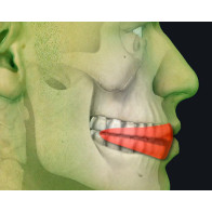 ELASTODONZIA PLUS: LA TERAPIA ORTODONTICA FUNZIONALE DALLA DENTATURA DECIDUA A QUELLA PERMANENTE