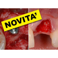 RIGENERAZIONE OSSEA CON TECNICHE SEMPLIFICATE + TECNICHE E STRATEGIE CHIRURGICHE PER GLI IMPIANTI NELLE ZONE ESTETICHE: