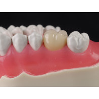 LA PROTESI DI TUTTI I GIORNI SU DENTE NATURALE (con tecnica B.O.P.T.) PREPARAZIONI - CORSO TEORICO-PRATICO FU