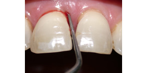 STAGING - GRADING - MINST - LINEE GUIDA