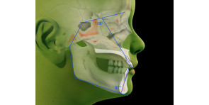 ELASTODONZIA PLUS + LA DIAGNOSI IN ORTODONZIA