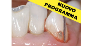 MALATTIE PARADONTALI E PERI-IMPLANTITI: PROTOCOLLI CLINICI
