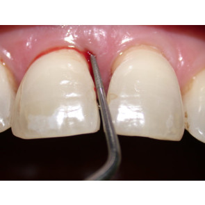 STAGING - GRADING - MINST - LINEE GUIDA