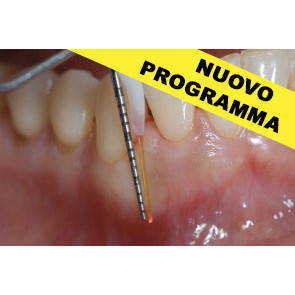 TERAPIA PARODONTALE LASER ASSISTITA e altre indicazioni dei laser a diodo e a erbio in ambito odontoiatrico