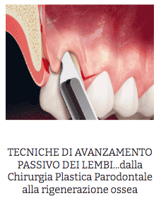 allungamento corona clinica