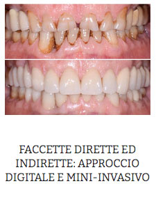  ODONTOIATRIA ESTETICA: L'APPROCCIO DIGITALE