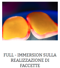 corso full immersion sulla realizzazione di faccette prosper